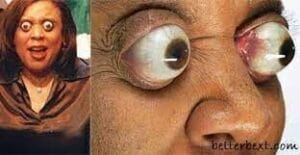 Read more about the article Kim Goodman: The Woman with the Biggest Eyeballs in the World