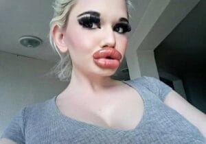 Read more about the article Andrea Ivanova: The 24-Year-Old Bulgarian Woman with the ‘Biggest Lips in the World’