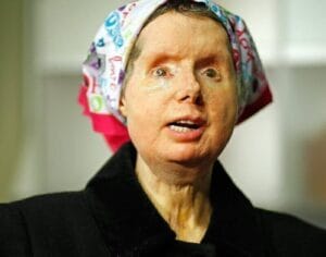 Read more about the article Travis The Chimp’s Gruesome Attack That Left A Woman Without A Face